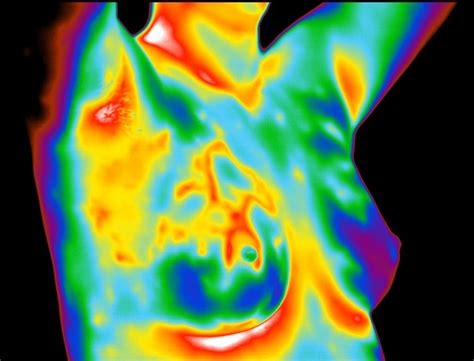 Contemporary Analysis of Breast Thermography, Piana, Sepper