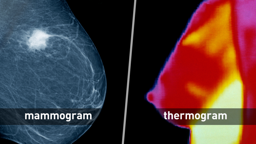 Thermography Research